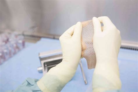 Synthetic grafts tissue procedure